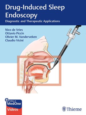 cover image of Drug-Induced Sleep Endoscopy
